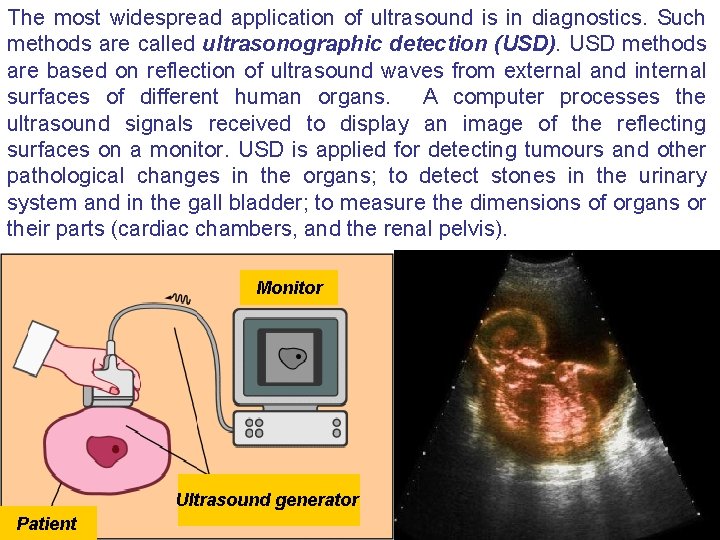 The most widespread application of ultrasound is in diagnostics. Such methods are called ultrasonographic