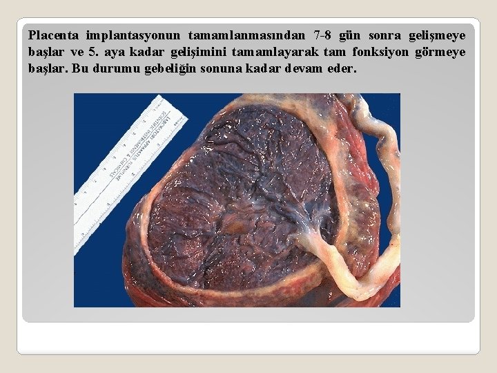 Placenta implantasyonun tamamlanmasından 7 -8 gün sonra gelişmeye başlar ve 5. aya kadar gelişimini