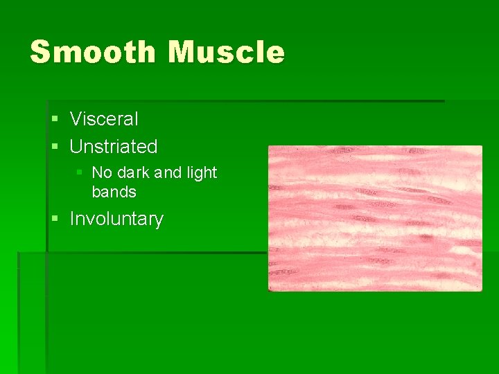 Smooth Muscle § Visceral § Unstriated § No dark and light bands § Involuntary