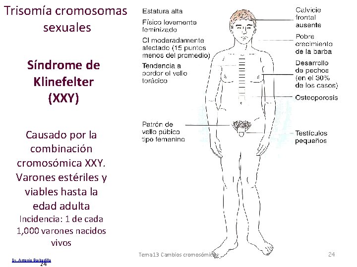 Trisomía cromosomas sexuales Síndrome de Klinefelter (XXY) Causado por la combinación cromosómica XXY. Varones