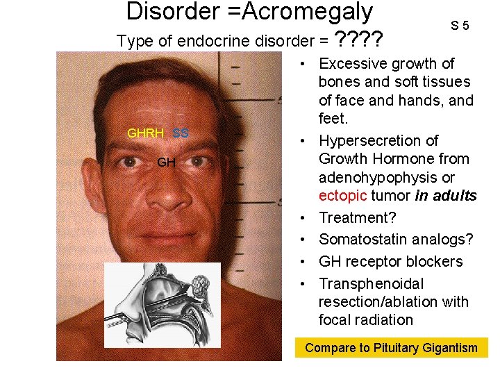 Disorder =Acromegaly Type of endocrine disorder = ? ? GHRH SS GH S 5