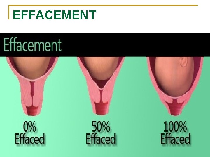 EFFACEMENT 
