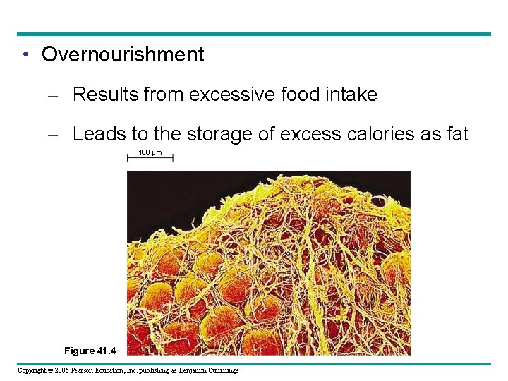  • Overnourishment – Results from excessive food intake – Leads to the storage