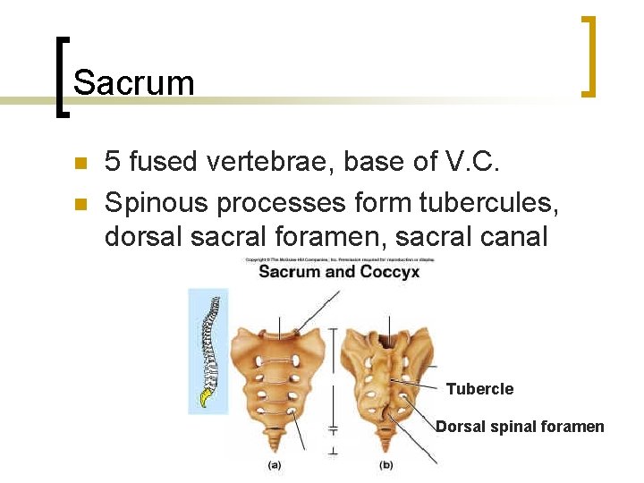 Sacrum n n 5 fused vertebrae, base of V. C. Spinous processes form tubercules,