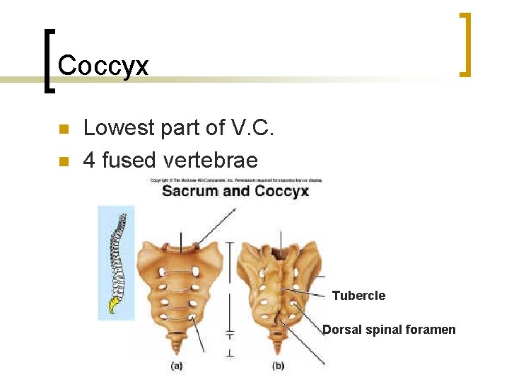 Coccyx n n Lowest part of V. C. 4 fused vertebrae Tubercle Dorsal spinal
