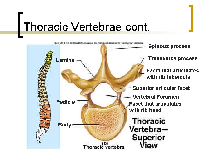 Thoracic Vertebrae cont. Spinous process Lamina Transverse process Facet that articulates with rib tubercule