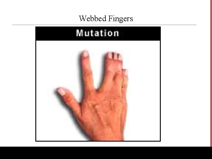 Webbed Fingers www. Bio. Ed. Online. org 