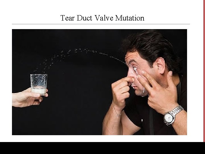 Tear Duct Valve Mutation www. Bio. Ed. Online. org 