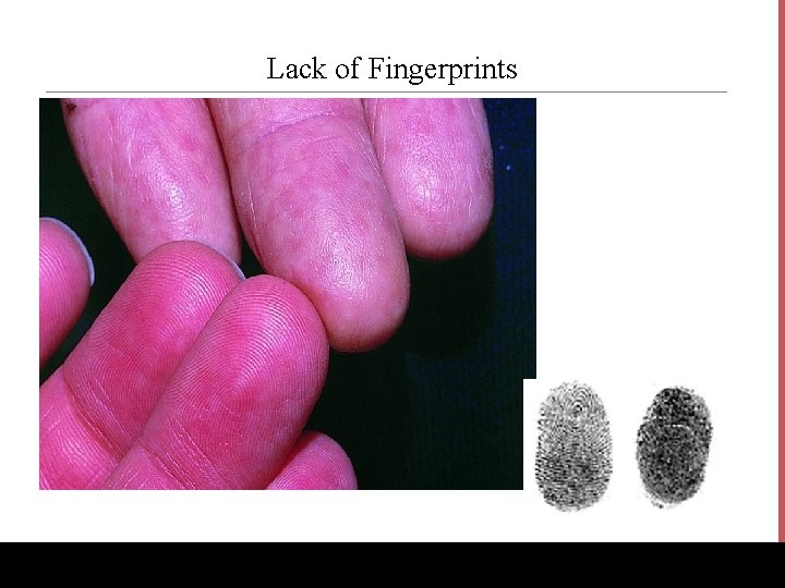 Lack of Fingerprints www. Bio. Ed. Online. org 