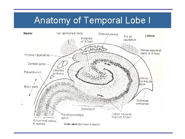 Anatomy of Temporal Lobe I 