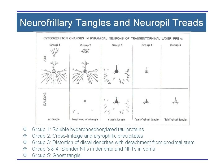 Neurofrillary Tangles and Neuropil Treads ± ± ± Group 1: Soluble hyperphosphorylated tau proteins