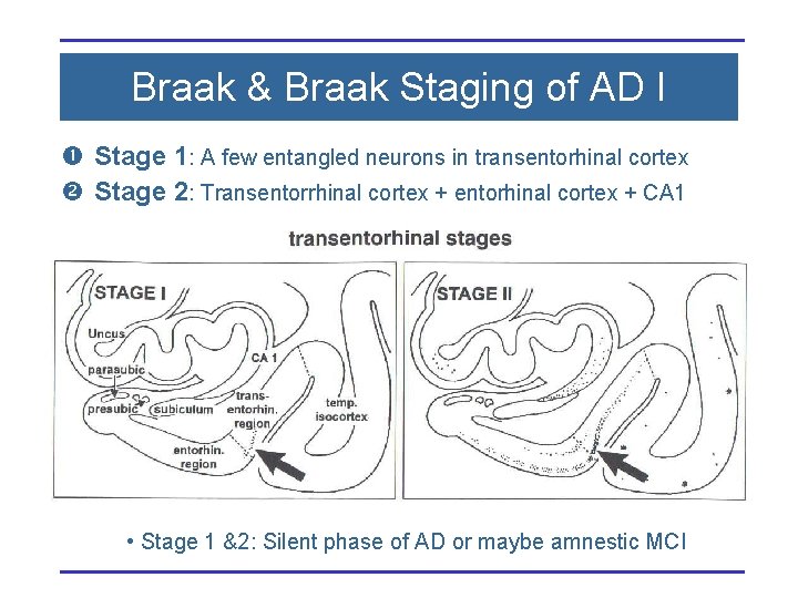 Braak & Braak Staging of AD I Stage 1: A few entangled neurons in
