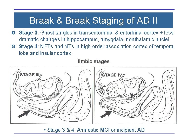 Braak & Braak Staging of AD II Stage 3: Ghost tangles in transentorhinal &