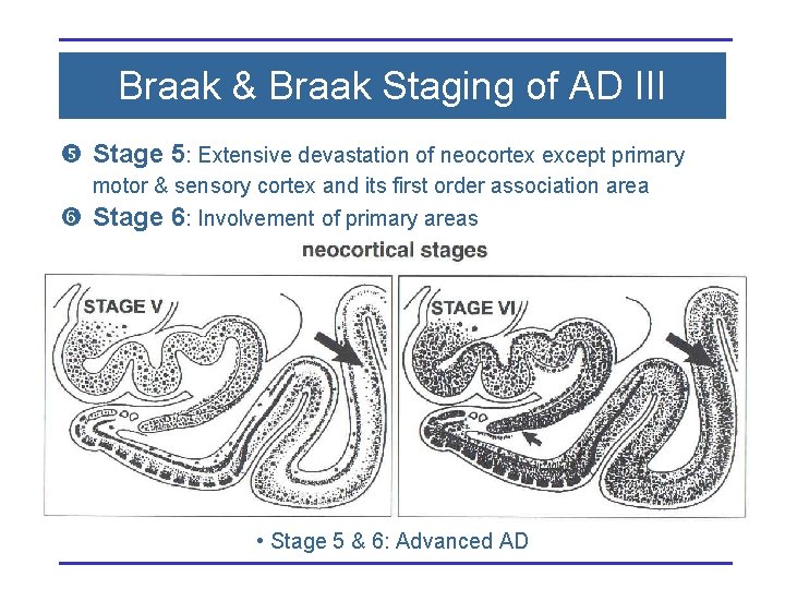 Braak & Braak Staging of AD III Stage 5: Extensive devastation of neocortex except