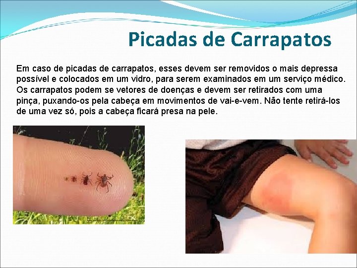 Picadas de Carrapatos Em caso de picadas de carrapatos, esses devem ser removidos o