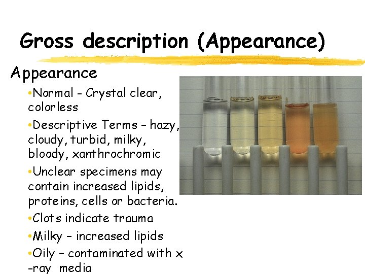 Gross description (Appearance) Appearance • Normal - Crystal clear, colorless • Descriptive Terms –