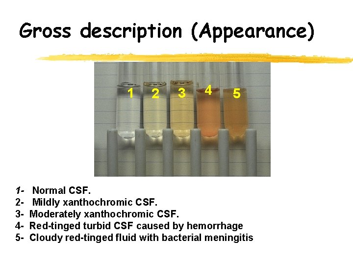 Gross description (Appearance) 1 12345 - 2 3 4 5 Normal CSF. Mildly xanthochromic