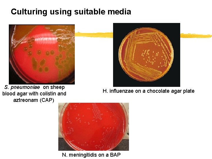 Culturing using suitable media S. pneumoniae on sheep blood agar with colistin and aztreonam