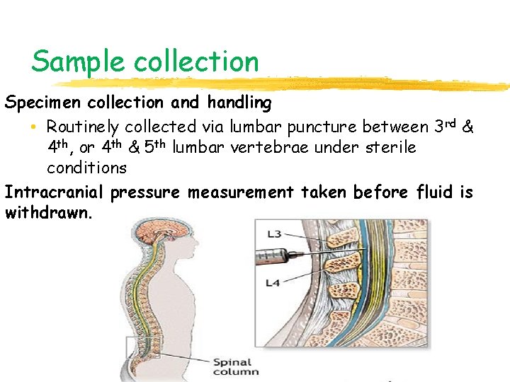 Sample collection Specimen collection and handling • Routinely collected via lumbar puncture between 3