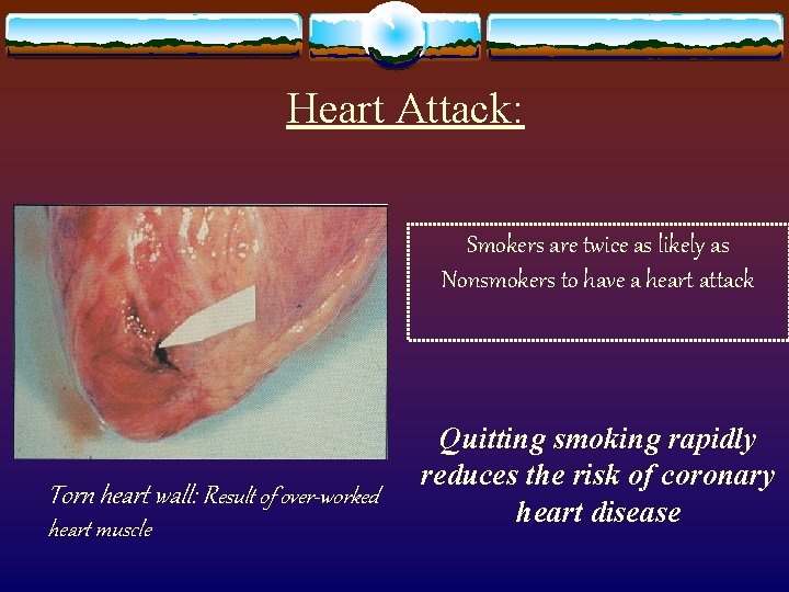 Heart Attack: Smokers are twice as likely as Nonsmokers to have a heart attack