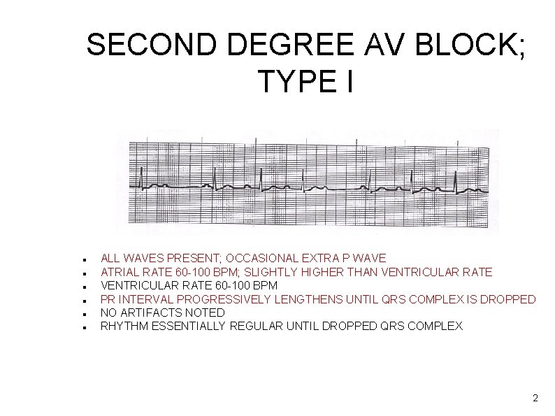 SECOND DEGREE AV BLOCK; TYPE I ALL WAVES PRESENT; OCCASIONAL EXTRA P WAVE ATRIAL