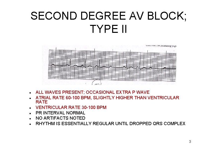 FIRST DEGREE AV BLOCK ALL WAVES PRESENT NORMAL