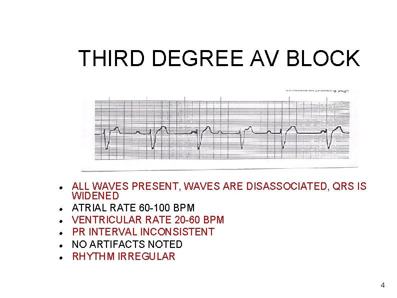 THIRD DEGREE AV BLOCK ALL WAVES PRESENT, WAVES ARE DISASSOCIATED, QRS IS WIDENED ATRIAL