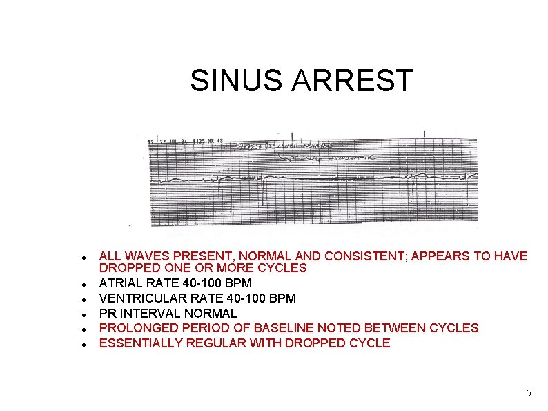 SINUS ARREST ALL WAVES PRESENT, NORMAL AND CONSISTENT; APPEARS TO HAVE DROPPED ONE OR