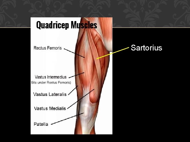 Sartorius 