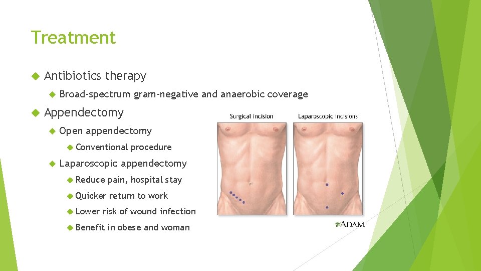 Treatment Antibiotics therapy Broad-spectrum gram-negative and anaerobic coverage Appendectomy Open appendectomy Conventional procedure Laparoscopic