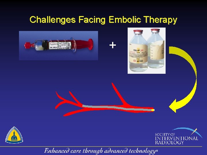 Challenges Facing Embolic Therapy + 