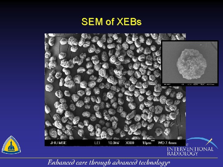 SEM of XEBs 