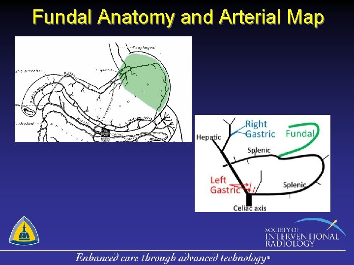 Fundal Anatomy and Arterial Map 