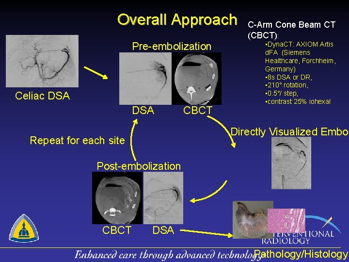 Overall Approach Pre-embolization Celiac DSA CBCT C-Arm Cone Beam CT (CBCT): • Dyna. CT: