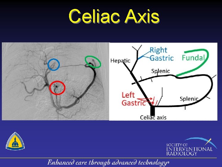 Celiac Axis 