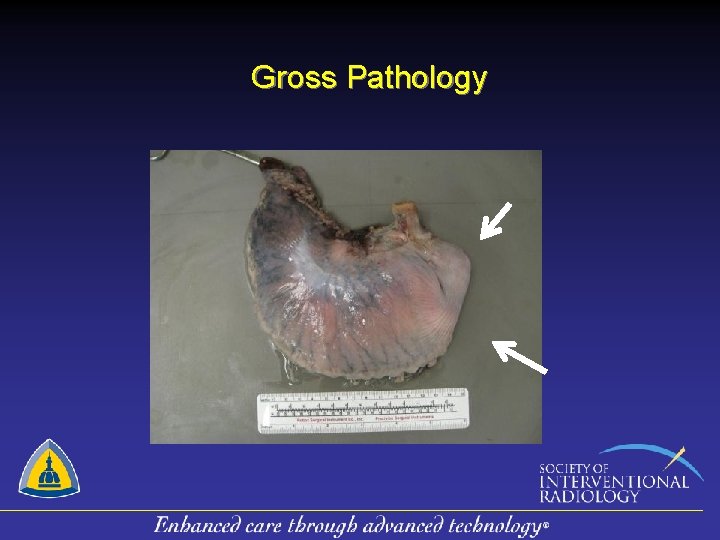 Gross Pathology 