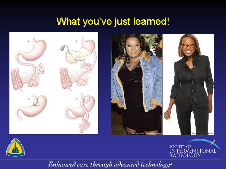 What you’ve just learned! 