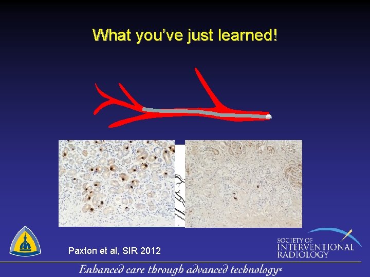 What you’ve just learned! Paxton et al, SIR 2012 