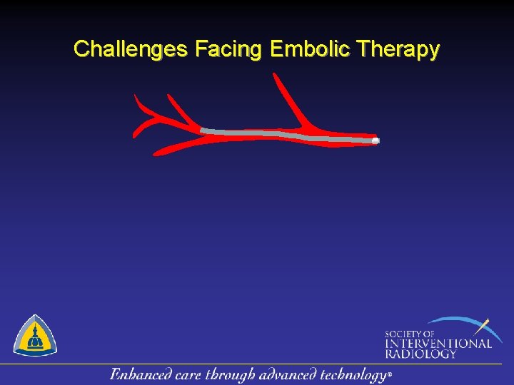 Challenges Facing Embolic Therapy 