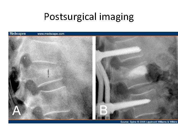 Postsurgical imaging 