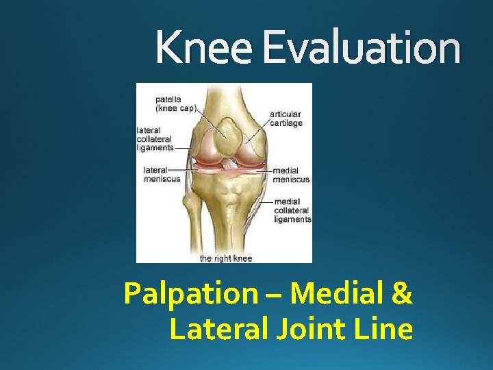 Knee Evaluation Palpation – Medial & Lateral Joint Line 