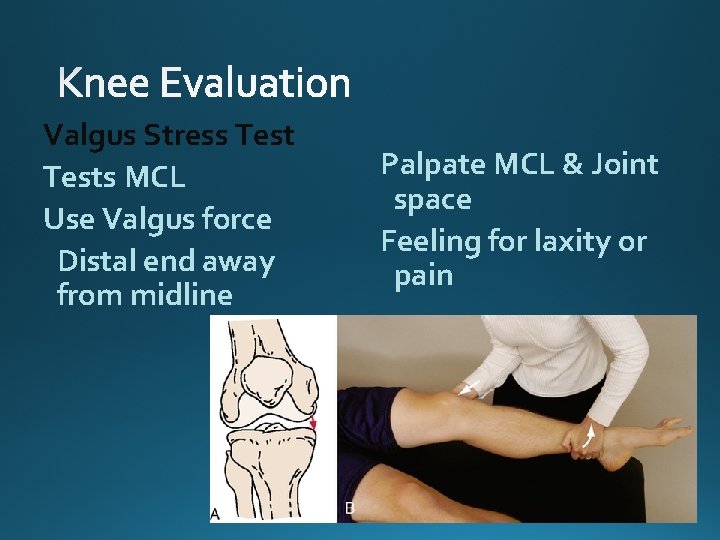 Valgus Stress Tests MCL Use Valgus force Distal end away from midline Palpate MCL