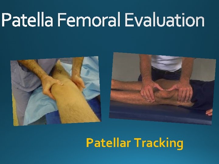 Patella Femoral Evaluation Patellar Tracking 