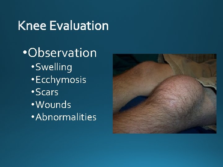  • Observation • Swelling • Ecchymosis • Scars • Wounds • Abnormalities 