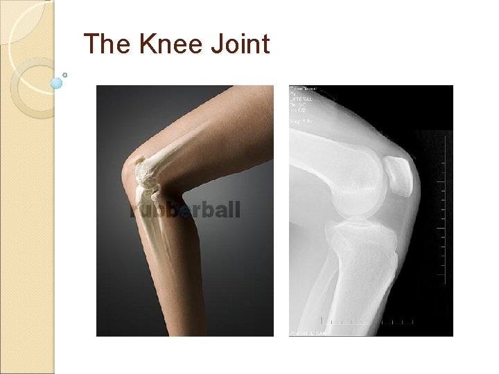 The Knee Joint The Knee Joint
