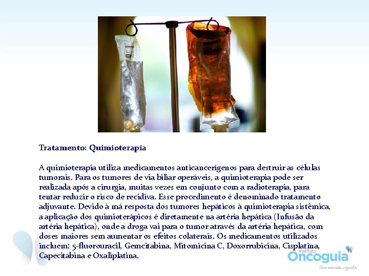 Tratamento: Quimioterapia A quimioterapia utiliza medicamentos anticancerígenos para destruir as células tumorais. Para os