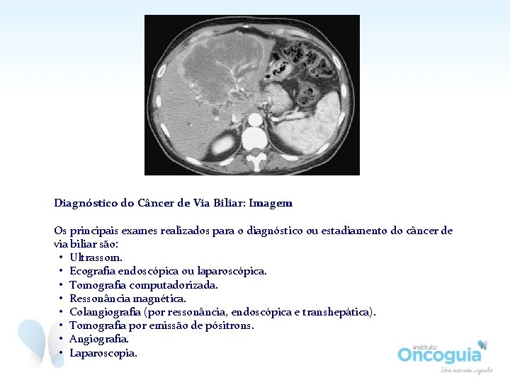 Diagnóstico do Câncer de Via Biliar: Imagem Os principais exames realizados para o diagnóstico