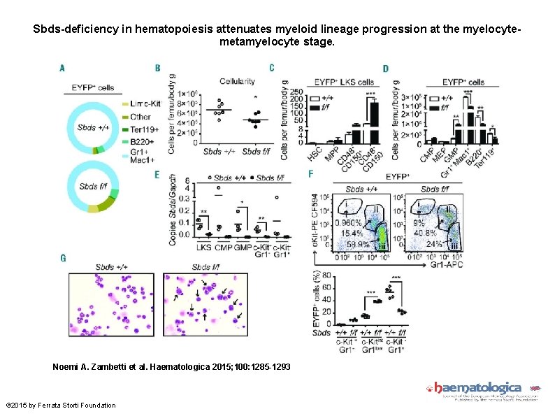 Sbds-deficiency in hematopoiesis attenuates myeloid lineage progression at the myelocytemetamyelocyte stage. Noemi A. Zambetti