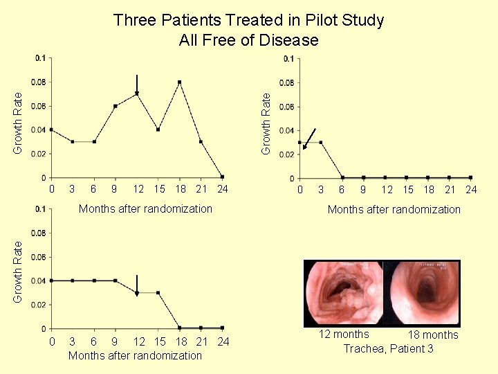 Growth Rate Three Patients Treated in Pilot Study All Free of Disease 0 3