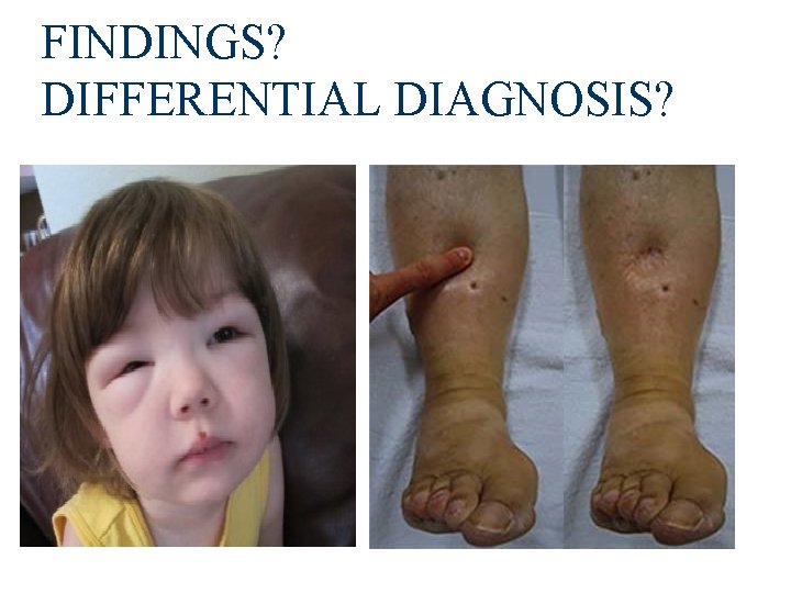 FINDINGS? DIFFERENTIAL DIAGNOSIS? 